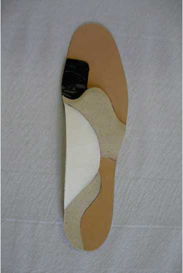 Construction d'une semelle classique pour hallux valgus avant recouvrement